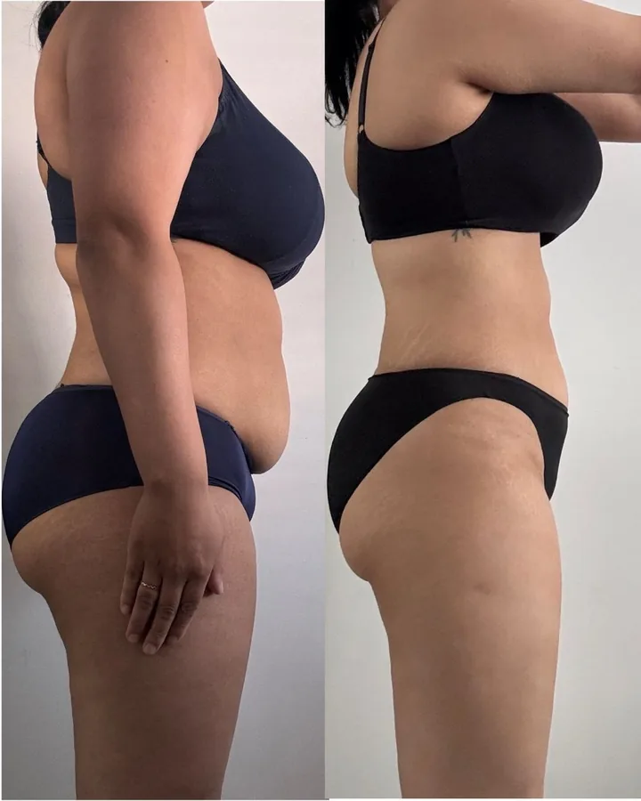Client transformation, 24lbs down