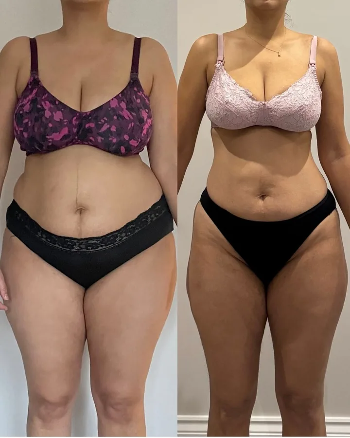 Client transformation, before and after
